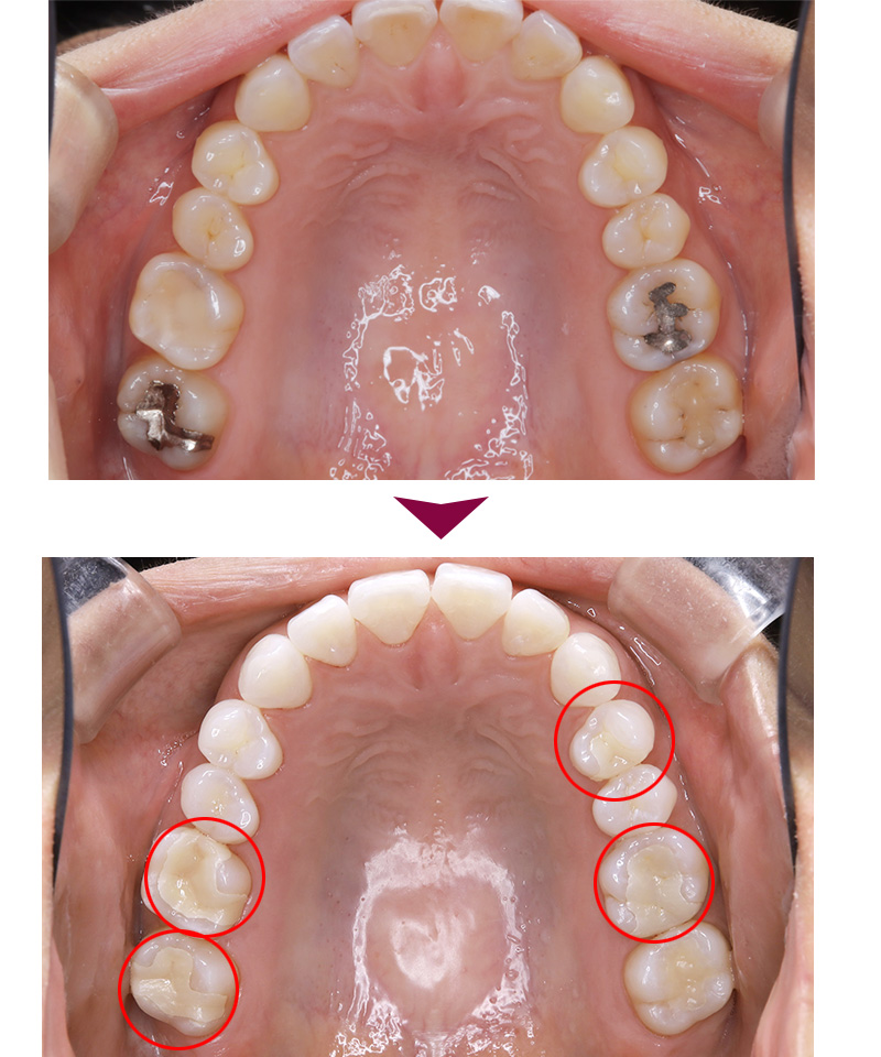 Before&After