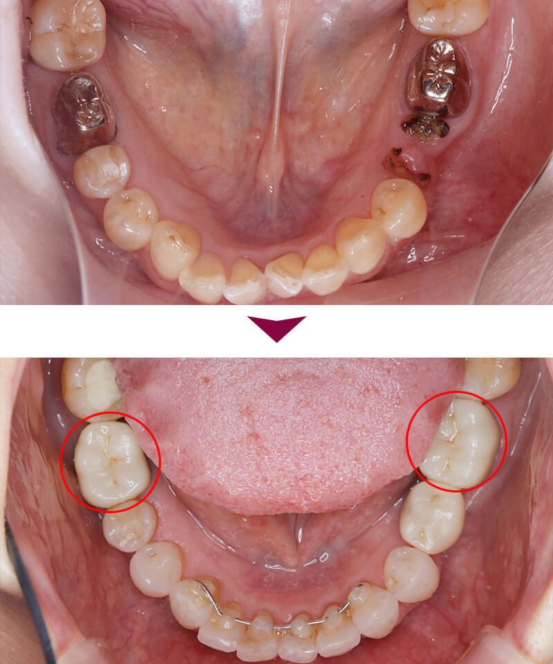 Before&After