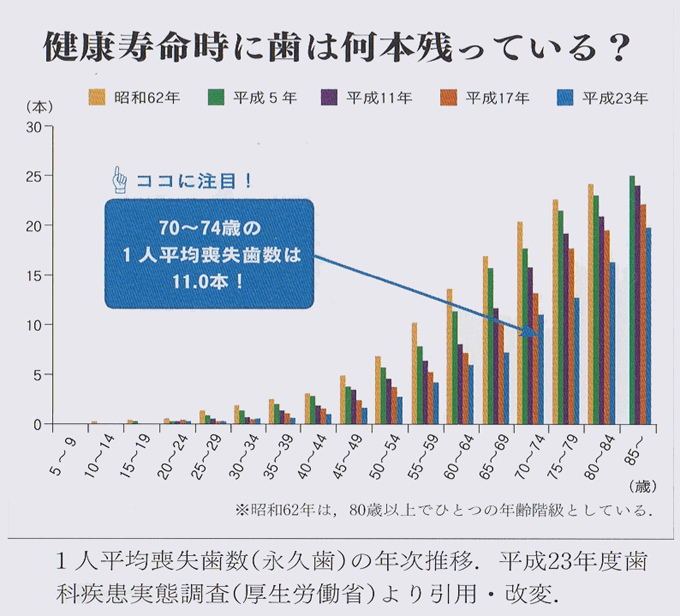 健康寿命時に歯は何本残っている？